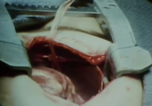 Faces of death